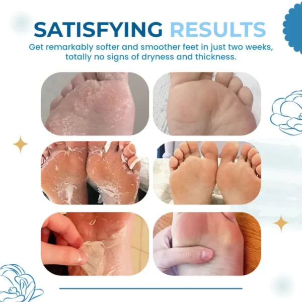 MilkySkin 3D Intense Exfoliating Foot Pad