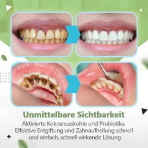 TLOPA™ Ampulle Zahnpasta, Entfernung von Zahnstein und Plaque-Bakterien und verschiedene orale Probleme