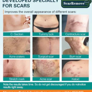 ScarRemove™ Advanced Scar Spray For All Types of Scars