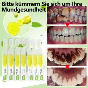 TLOPA™ Ampulle Zahnpasta, Entfernung von Zahnstein und Plaque-Bakterien und verschiedene orale Probleme