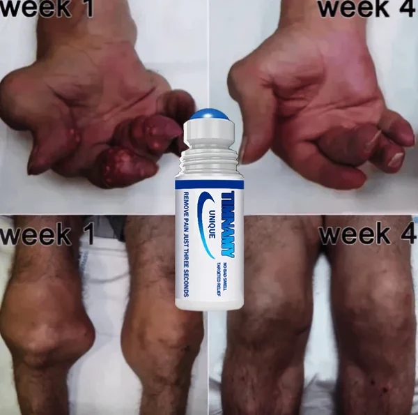 TIMNAMY™ Joint and Bone Therapy Roll-on liquid - Full Body can be applied-pain disappear