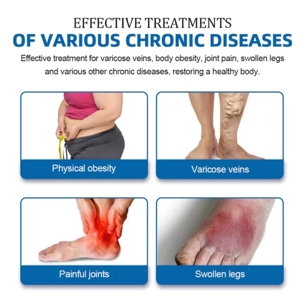 TrimVein™ Varicose Vein Care and Slimming Cream