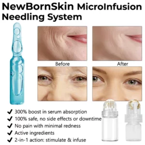 Oveallgo™ NewBornSkin MicroInfusion Needling System