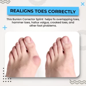 Alayna™ 3D Bunion Splint Corrector