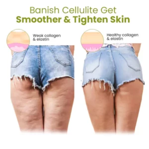 Beautie™ HerbalFirm Cellulite Reduction Patches