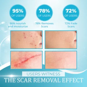 OrgPure™ Organic Scar Removing Gel