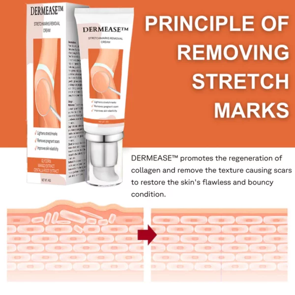 DERMEASE™ Stretchmarks Removal Cream