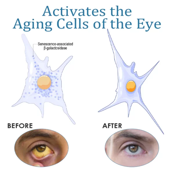 Engulor Treatment EyeProblems SolutionDrops