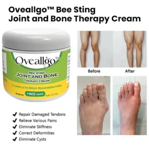 Oveallgo™ PRO Bee Sting Joint and Bone Therapy Cream - Complete Body Regeneration