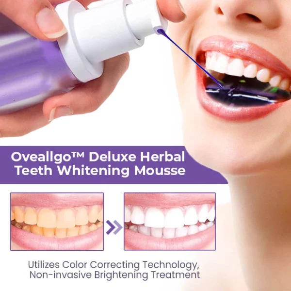 Fivfivgo™ Deluxe Herbal Teeth Whitening Mousse
