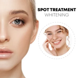SkinSpot WhiteningFreckle Cream