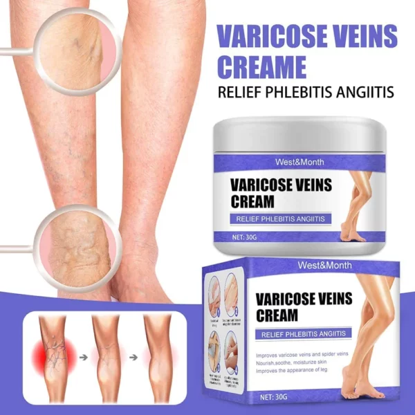 VeinRelief Varicose Treatment Cream