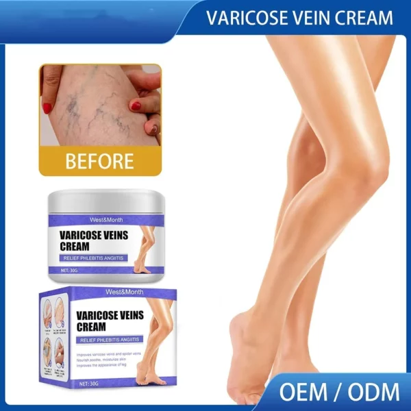 VeinRelief Varicose Treatment Cream