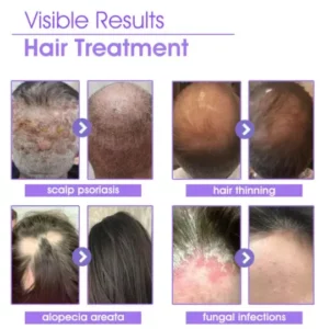 Healsy™ Super Nourishing Hair Follicle Repair Hair Growth Drops