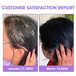 Healsy™ Super Nourishing Hair Follicle Repair Hair Growth Drops