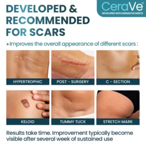 CERAVY™ Advanced Scar Removal Gel