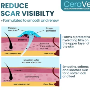 CERAVY™ Advanced Scar Removal Gel