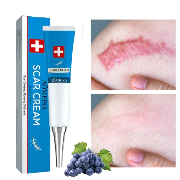 Treatment Stretch Marks Scar Removal Cream Gel