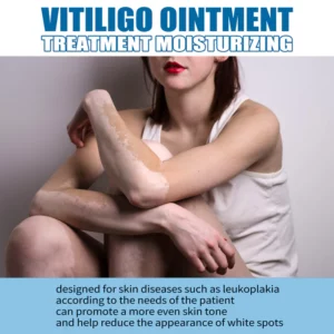 Vitiligo Treatment Ointment