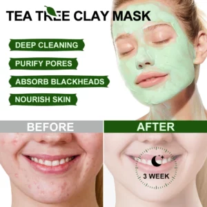 LuxiaSkins™️ Tea Tree Pore Cleansing Facial Mask