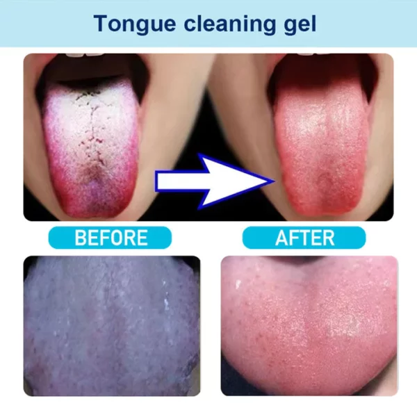 Tongue Cleaning Gel With Brush