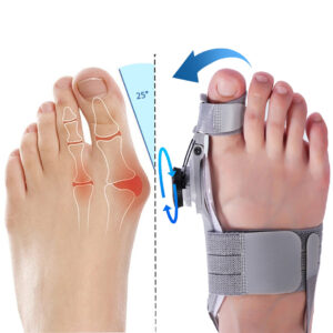 Bunion Fix – Natural At-Home Bunion Relief