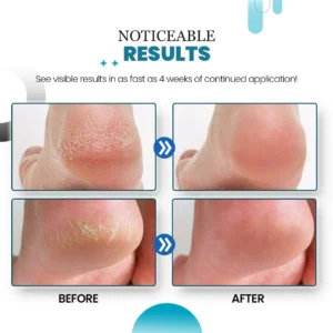 HeelHaven Severe Cracked Heel Balm