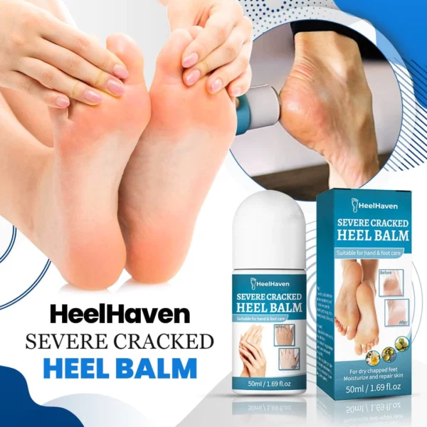 HeelHaven Severe Cracked Heel Balm