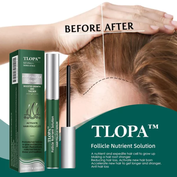 Buy One, Get One Free-TLOPA™ Follicle Nutrient Solution