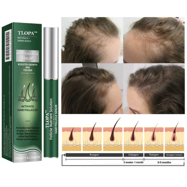Buy One, Get One Free-TLOPA™ Follicle Nutrient Solution