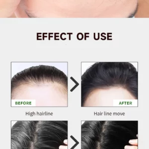 GlowWave Follicle Boost Master