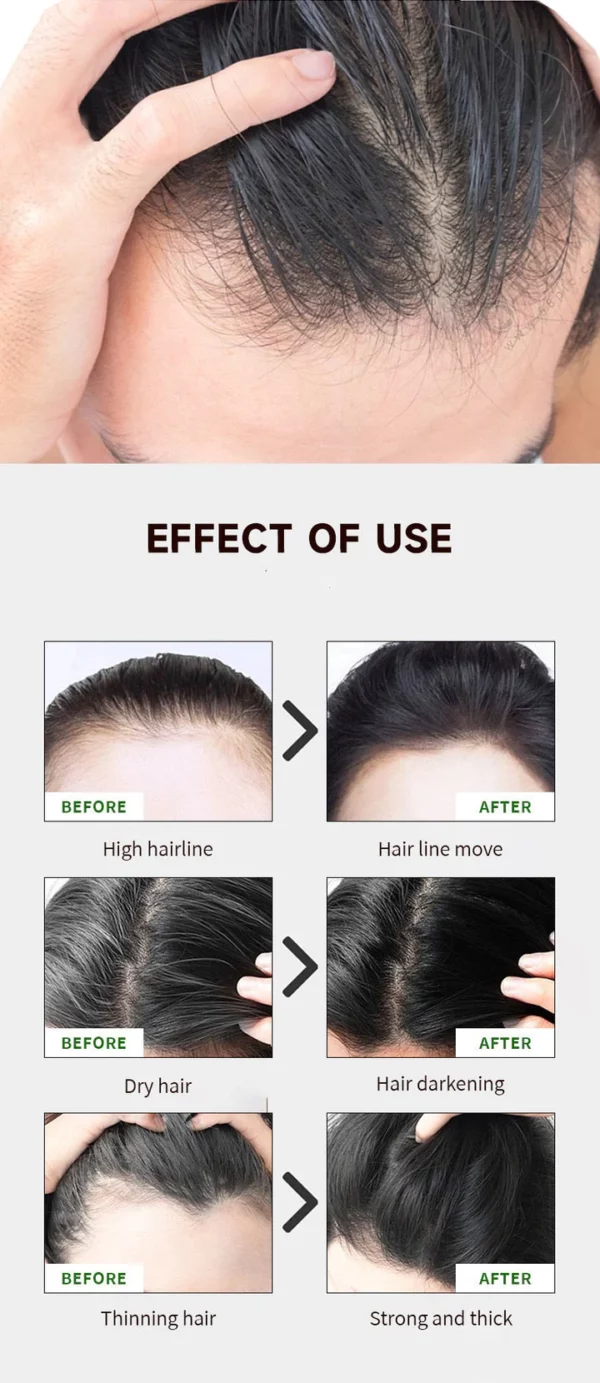 GlowWave Follicle Boost Master