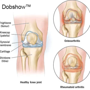Dobshow™ Joint & Bone Therapy Bee Venom Treatment Gel