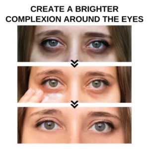 Nurbini™ Clinical SkinCare Instant Eye Tightener