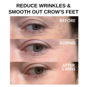 Oveallgo™ Clinical SkinCare Instant Eye Tightener