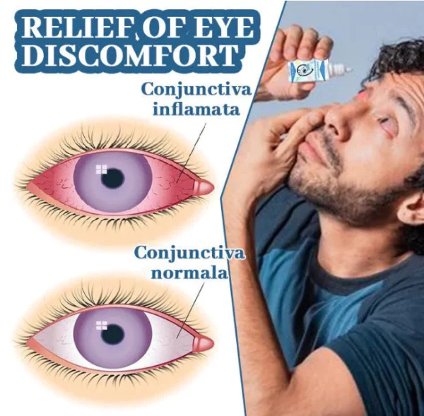 Myopia Reversal Eye Drops