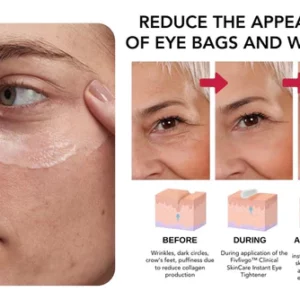 Oveallgo™ Clinical SkinCare Instant Eye Tightener