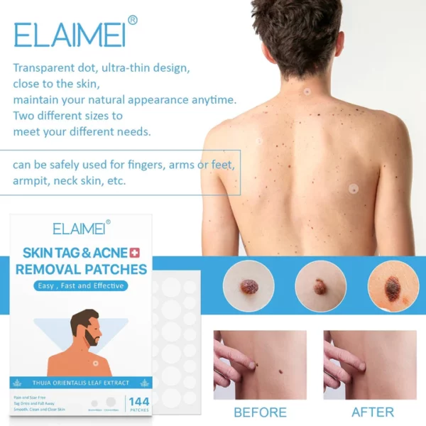 BEING WESTERN™ Elamei Skin Tag Patches® 144pcs