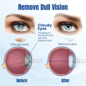 Ceoerty™ OptiRenew Eye Treatment Drops