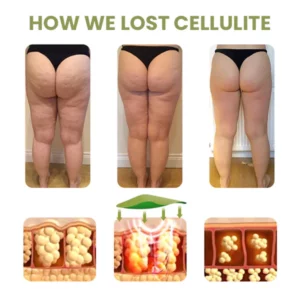 Dobshow™ Ultimate Smooth Cellulite Reduction Patches