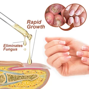 Dobshow™ 7 Days Growth and Strengthening Nail Serum