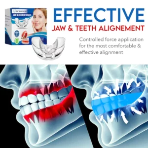 DOBSHOW™ Jaw Alignment Brace