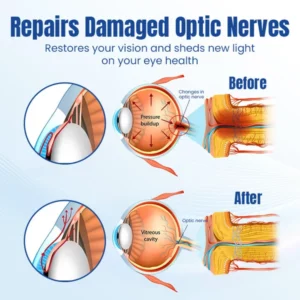 Ceoerty™ OptiRenew Eye Treatment Drops