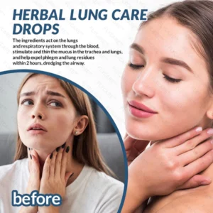 FLYCARE™ Herbal Lung Care Drops