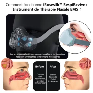 iRosesilk™ RespiRevive EMS Nasaltherapie-Instrument