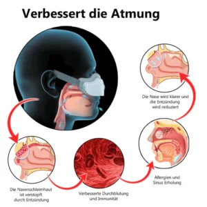 iRosesilk™ RespiRevive EMS Nasaltherapie-Instrument