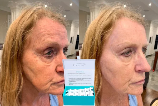Tiworld™ Luxury Botox Intense Anti-Wrinkle Cream