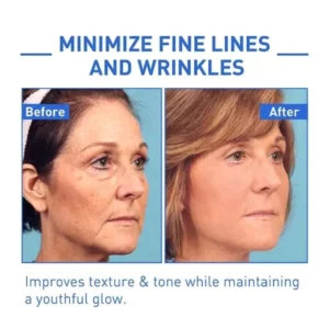 Tiworld™ Luxury Botox Intense Anti-Wrinkle Cream