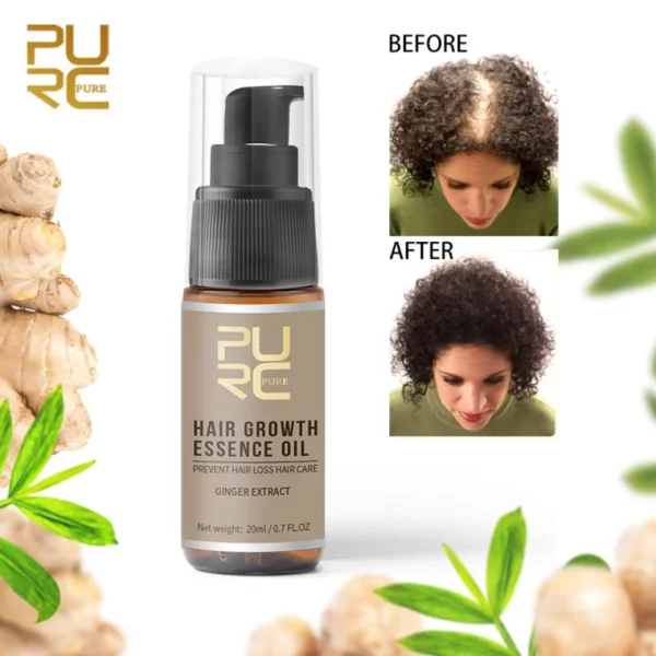 Fast Hair Growth Ginger Essence Oil