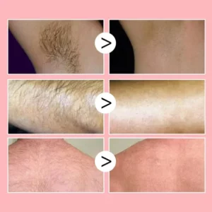 Mousse Hair Removal Spray